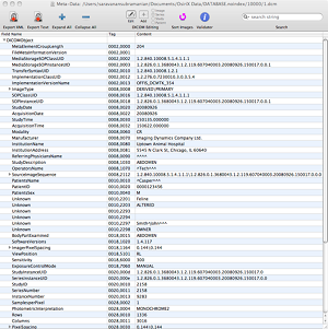 Osirix Structured Reporting